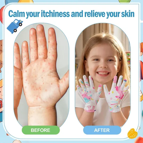 Vista 4 de 20 pares de guantes de eccema para niños, guantes hidratantes para piel irritada sensible, eccema, reutilizables, elásticos, suaves y no duelen