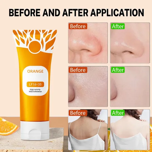 Vista 6 de 2 unidades de gel exfoliante naranja para cara y cuerpo, exfoliante de gel limpiador 2026, exfoliante facial de gel pelador de naranja, exfoliante
