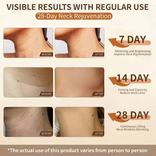 Vista 6 de Crema reafirmante para el cuello, aprieta y levanta la crema para el cuello, la crema para apretar el cuello mejora la flacidez, el estiramiento