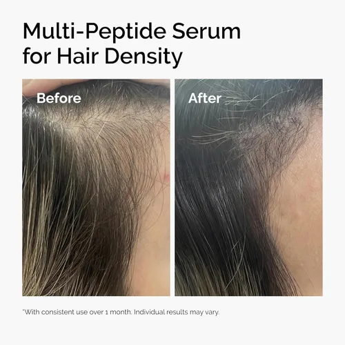 Vista 7 de The Ordinary Multi-Peptide Serum for Hair Density, Peptide-Powered Formula for Thicker, Fuller Looking Hair