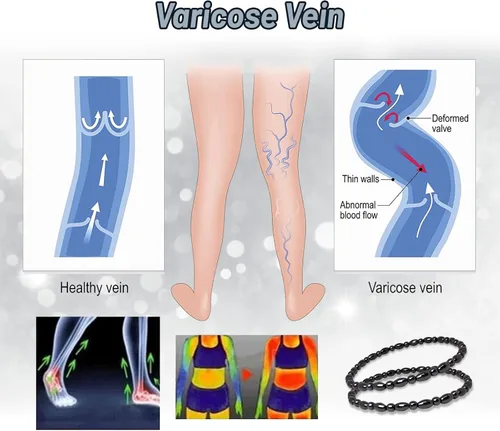 Vista 4 de Hion Paquete de 2 tobilleras de terapia de hematita para mujereshombres