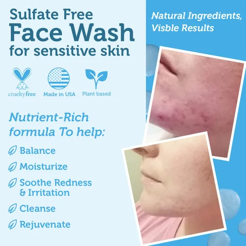Vista 5 de Era Organics Natural Face Wash 4 onzas, Hidratante Facial Limpiador Suave con Aloe Vera y miel de Manuka para sanar y renovar tu piel. PH