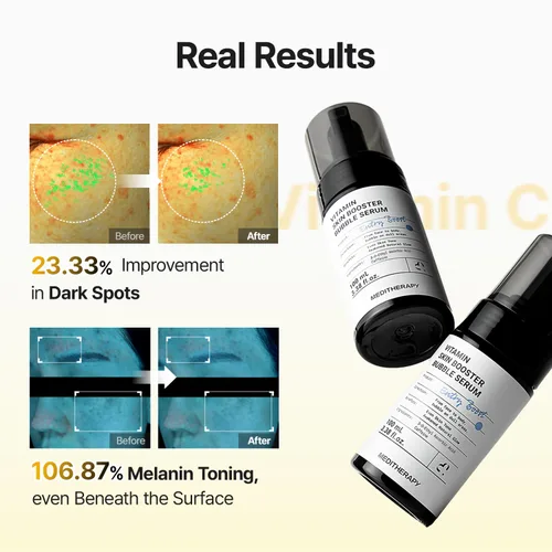 Vista 9 de MEDITHERAPY Suero de vitamina C para la cara, fórmula de microburbujas para absorción instantánea, brillo visiblemente radiante, vitamina C