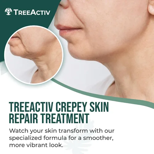 Vista 2 de TreeActiv Crepey Skin Repair Treatment, 8oz, crema reafirmante para cara y cuello, loción reafirmante y tensora de la piel con ácido hialurónico