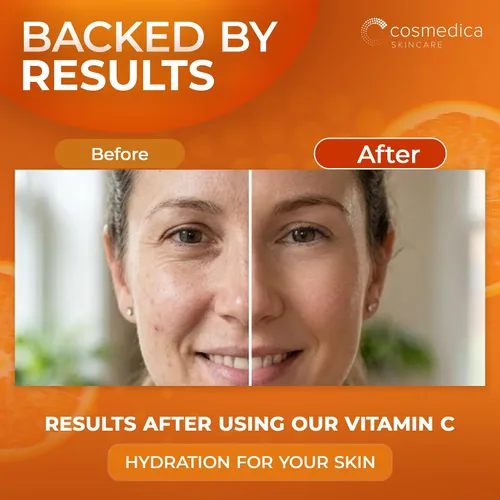 Vista 5 de Suero con 20% de vitamina C y E + ácido ferúlico, suero con 72% de ácido hialurónico, extractos naturales e ingredientes orgánicos, suero