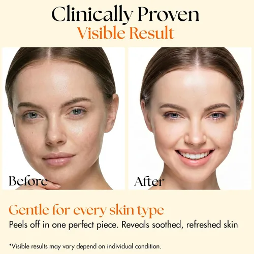Vista 6 de Clinical Resolution PDRN Máscara de colágeno para envolver la noche, todo en uno, nutre, revitaliza, resplandor para una piel joven brillante