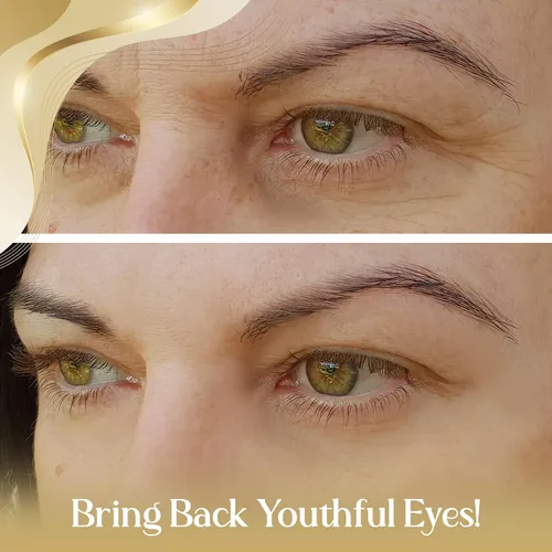 Vista 2 de OROGOLD Suero intensivo para ojos 24K - Suero debajo de los ojos para ayudar a reducir el aspecto de las ojeras y la hinchazón - Oro, té verde, aloe