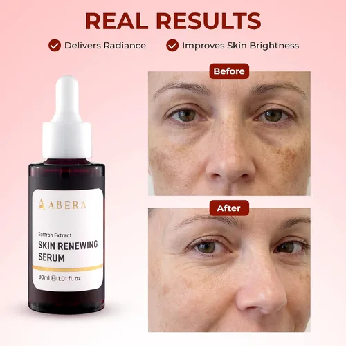 Vista 4 de ABERA Suero de azafrán renovador, tratamiento de melasma de alta potencia para cara y cuerpo, removedor de manchas oscuras para la edad, pecas