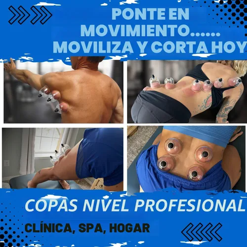 Vista 9 de Cupping Warehouse Juego de terapia de ventosas de policarbonato Poly Cups™ de 20 piezas Duradero y ligero PT, kit de ventosas miofasciales