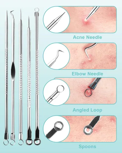 Vista 2 de Herramientas removedoras de puntos negros para Face EZBASICS Profesional Extractor de Comedones de Acero Inoxidable para Manchas y Puntos Blancos