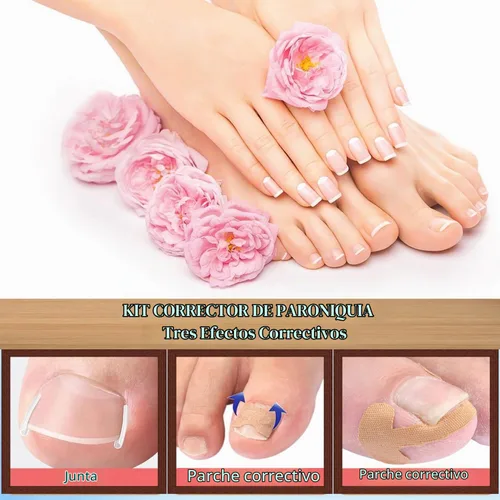 Vista 5 de Alivio rápido de las herramientas de pedicura del acero inoxidable del sistema del corrector de uñas encarnadas Breathable Ingrown Toenail Strips