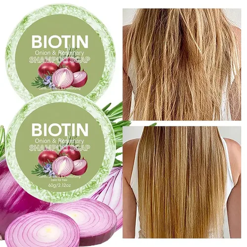 Vista 2 de 2 barras de champú de biotina de cebolla y romero para el crecimiento del cabello, barra de champú de biotina de cebolla para pérdida de cabello