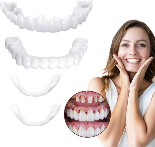 Vista 2 de Temporal: 2 pares para la restauración de la sonrisa - Ajustable, cómodo y de aspecto natural (2)
