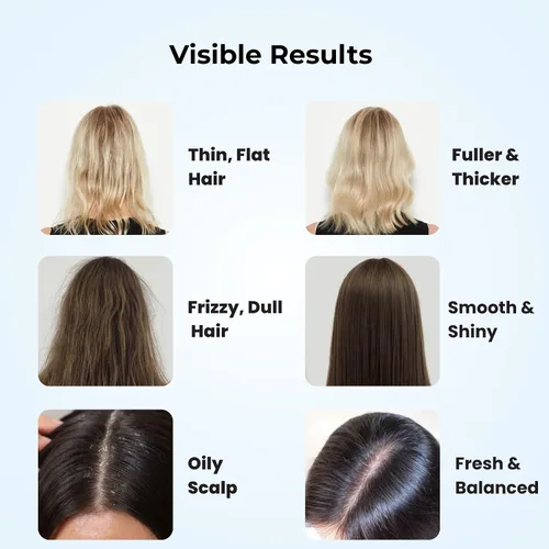 Vista 7 de Champú voluminizador y espesante para cabello fino y fino, fórmula de biotina Root Lift añade cuerpo instantáneo, plenitud y brillo, sin sulfato, 10