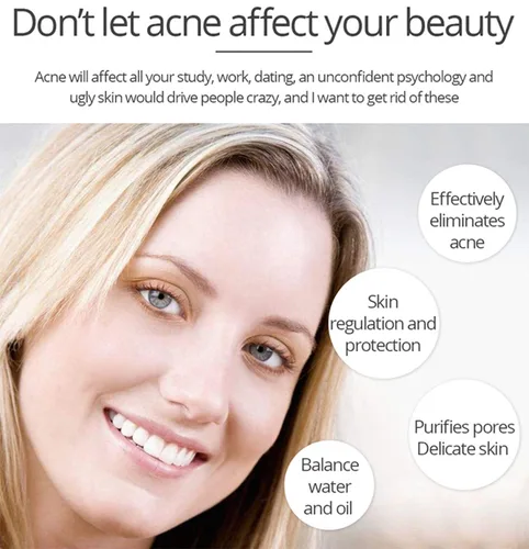 Vista 2 de AICHUN BEAUTY El ácido salicílico del extracto del aloe vera del suero facial anti-acné repara la piel dañada 1.0 fl oz