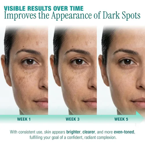 Vista 8 de Ebanel Eliminador de manchas oscuras para rostro y cuerpo, suero iluminador con Synovea HR, alfa arbutina, niacinamida, ácido kójico, corrector