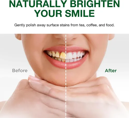 Vista 6 de Sri Sri Tattva Sudanta - Pasta de dientes de carbón - SLS, pasta de dientes herbales sin flúor con neem y hierbas ayurvédicas, blanqueamiento dental