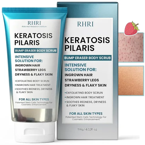 Vista 7 de Tratamiento de queratosis pilaris Loción de queratosis pilaris con 10% AHA Exfoliación suave para piernas de fresa, KP y pelos encarnados