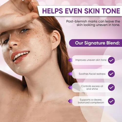 Vista 5 de AOBBIY Crema de Ácido Azelaico para la Cara: Crema Facial de Ácido Azelaico para Calmar el Enrojecimiento, Tono Desigual, Piel Proclive a Granos