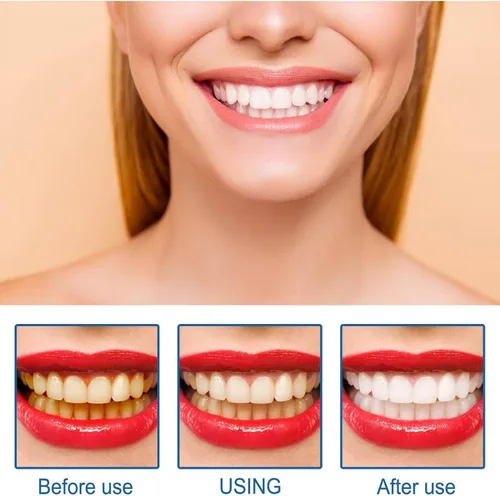 Vista 3 de Blanqueador de dientes en polvo, polvo de dientes de bicarbonato de sodio, sabor refrescante de menta, blanqueador de dientes eficaz, eliminación