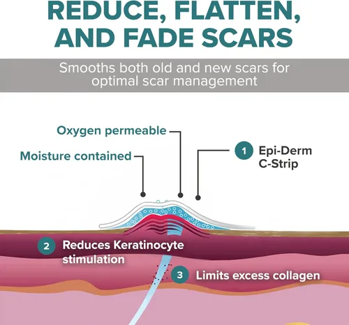 Vista 4 de Epiderm - Tiras de silicona para cicatrices, cinta de silicona de alta calidad para un cuidado óptimo de las cicatrices, versátil, flexible