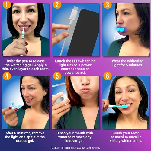 Vista 7 de GuruNanda Kit Premium de Blanqueamiento Dental con Luz LED Conectada y Lápiz Blanqueador, Funciona con iPhone y Android, Ayuda a Eliminar Manchas