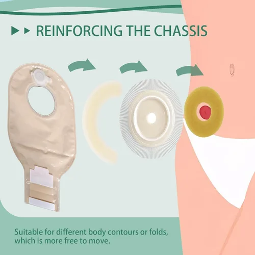 Vista 4 de 30 anillos de barrera para ostomía, sellos cohesivos de cinta hidrocoloide de 0.079 pulgadas de grosor, extensor elástico moldeable de piel