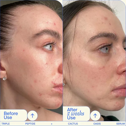 Vista 3 de Youth To The People Triple Peptide + suero facial Oasis - Suero hidratante + reafirmante para piel seca, rellena líneas finas con 4 tipos de ácido