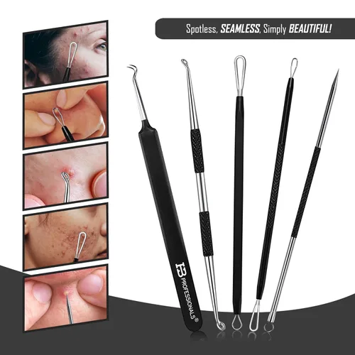 Vista 2 de Kit de herramientas para eliminar puntos negros, kit de 5 piezas, acero inoxidable de alta calidad, extractor de comedones de espinillas, extractor