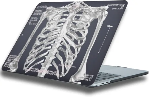 Vista 25 de Funda compatible con MacBook Air de 15 pulgadas M5 M4 M3 M2 2023 Negro (Black Lace)