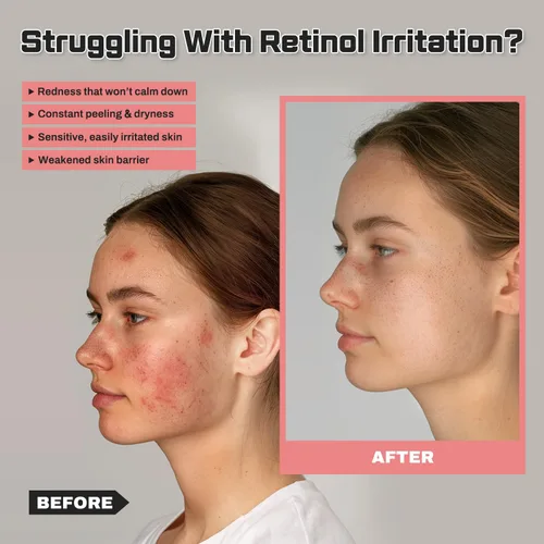 Vista 3 de Bakuchiol Retinol Alternativa Anti-Envejecimiento Hidratante para Piel Madura y Sensible con Péptidos y Ceramidas, Anti-Arrugas y Reparación