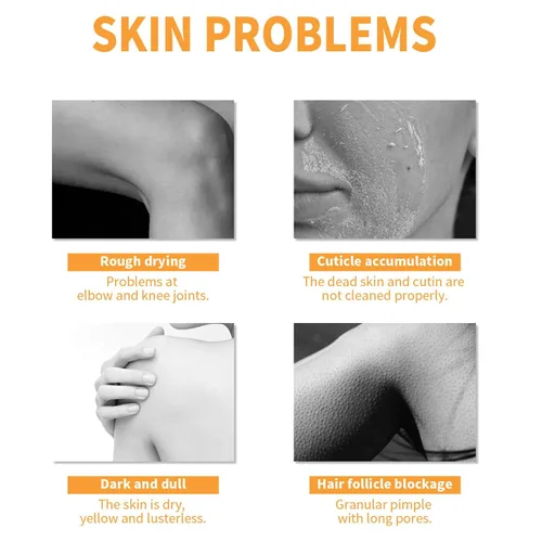Vista 4 de Gel exfoliante Papaya Essence, limpieza profunda, exfoliación, hidratación de la piel, para un tono de piel aburrido y desigual, elimina