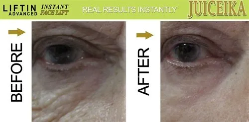 Vista 2 de LIFTIN Advanced" INSTANT FACE LIFT de Juiceika. ¡Este es un INCREÍBLE 60 SEGUNDO CARA LIFTIN!