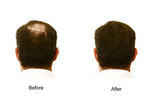 Vista 3 de My Secret - Potenciador de cabello castaño medio, 5 onzas, paquete de 3