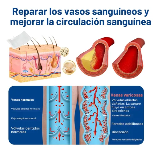 Vista 5 de Vein Target Microdarts Patch, tratamiento profesional de venas varicosas para piernas, parche GFOUK Vein Target, alivia la circulación sanguínea