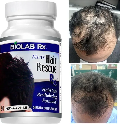 Vista 5 de Hair Rescue Rx - Suplemento para adelgazar el cabello para hombre con biotina y ortiga, soporta un cabello más grueso y saludable, soporte