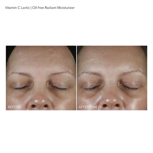 Vista 15 de Dr Dennis Gross VitC+Crema hidratante radiante sin aceite láctico, 1.7 fl oz/1.7 fl oz
