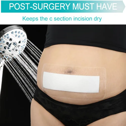 Vista 3 de C-Section - Vendajes de incisión abdominal impermeables para después de la histerectomía, protector de ducha para abdominoplastia, cubierta