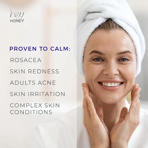 Vista 4 de Hey Honey Skincare Relax - Crema instantánea de alivio de rosácea para pieles sensibles Hidratante facial calmante para enrojecimiento e