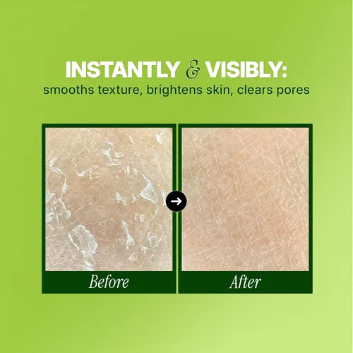 Vista 3 de Ebanel Exfoliante químico para cara, exfoliante AHA BHA, ácido glicólico, gel de pelado facial de ácido salicílico y láctico, infundido con té verde