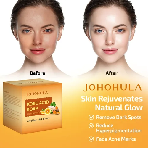 Vista 3 de Barras de jabón eliminadoras de manchas oscuras de ácido kójico con vitamina C, retinol, colágeno, cúrcuma, suaves para rostro y cuerpo, piel firme