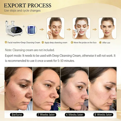 Vista 3 de Máquina profesional de belleza facial y corporal, dispositivo de ajuste de piel de alta frecuencia para reducción de arrugas y rejuvenecimiento