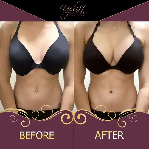 Vista 6 de Insertos de sujetador de silicona Almohadillas de gel transparente Push Up Sujetador acolchado Busto Enhancer