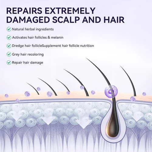 Vista 5 de Paquete de 2 aceites de minoxidil al 5% para hombres y mujeres, suero de crecimiento del cabello con masajeador del cuero cabelludo, espuma