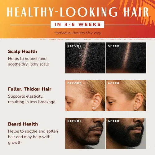 Vista 4 de Aceite de batana crudo orgánico para el crecimiento del cabello, para mujeres y hombres, batana natural puro de Honduras, 4 onzas, saludable, más