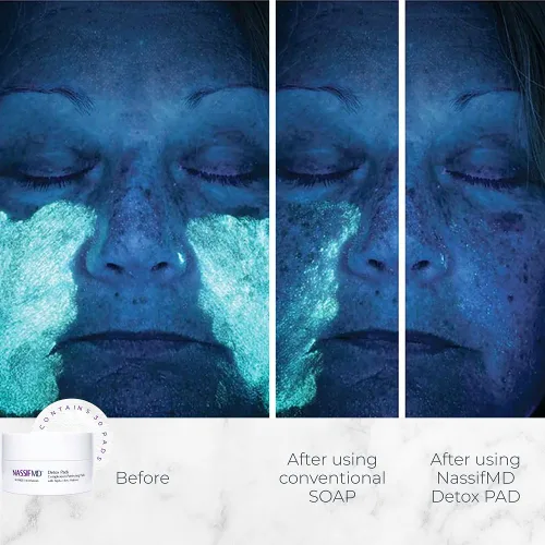 Vista 2 de NassifMD - Almohadillas de desintoxicación facial, almohadillas de ácido glicólico, tónico de hamamelis, almohadillas exfoliantes faciales toallitas