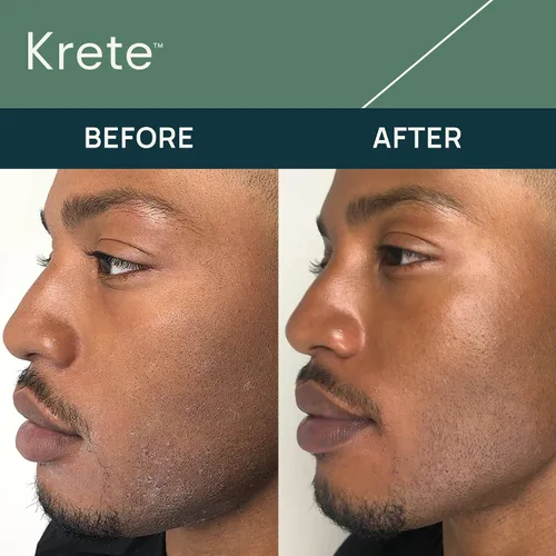 Vista 3 de KRETE Suero facial hidratante de 30 segundos para hombres, ayuda con la apariencia del envejecimiento, arrugas, bolsas de ojos y enrojecimiento.