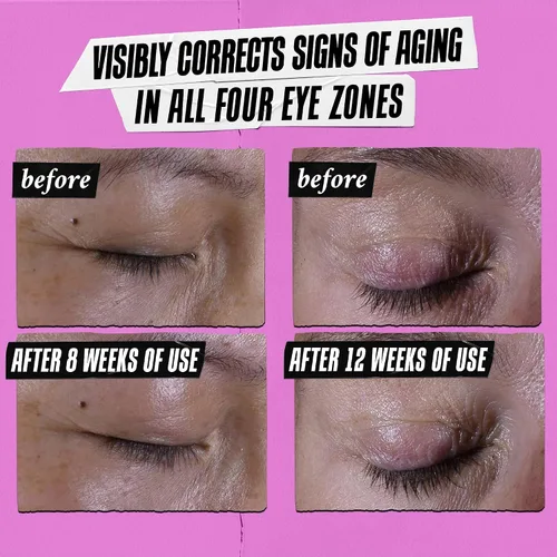 Vista 3 de Kiehl's Crema de ojos súper multicorrectora, crema antienvejecimiento que levanta el área del hueso de la ceja, suaviza y reafirma los párpados