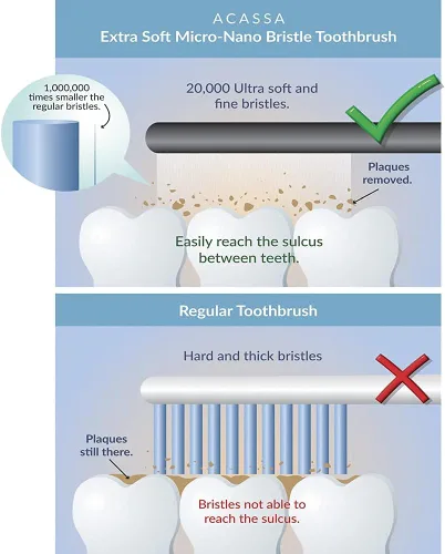Vista 6 de Cepillo de dientes súper suave, cepillo de dientes nano, micro cepillo de dientes, 20000 cerdas, cepillo de dientes de encías, cepillo de dientes