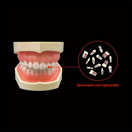 Vista 2 de Modelo de práctica de conducto radicular RCT dental, enseñanza, estudio (28 piezas/juego) Modelo de dientes, dientes endo, encaja con NISSIN Tipo